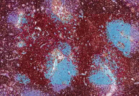 CD4/CD8 Ratio