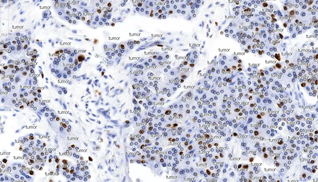 Ki-67 IHC stain