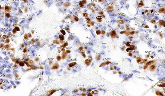 PR IHC stain